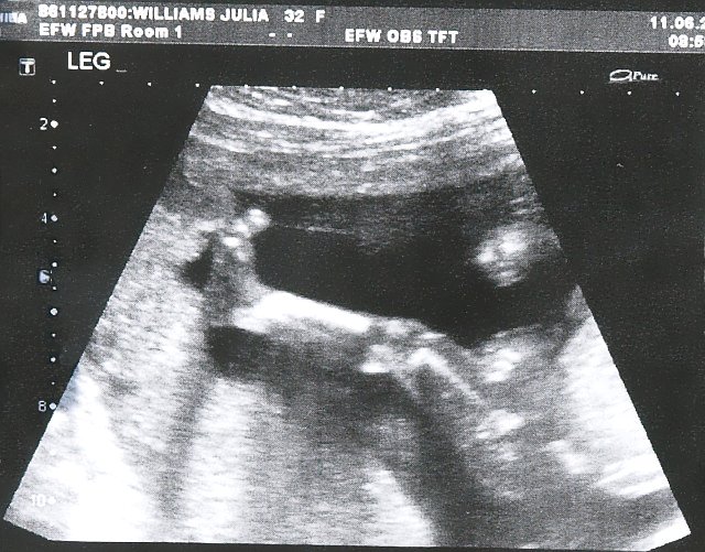 ultrasound 3