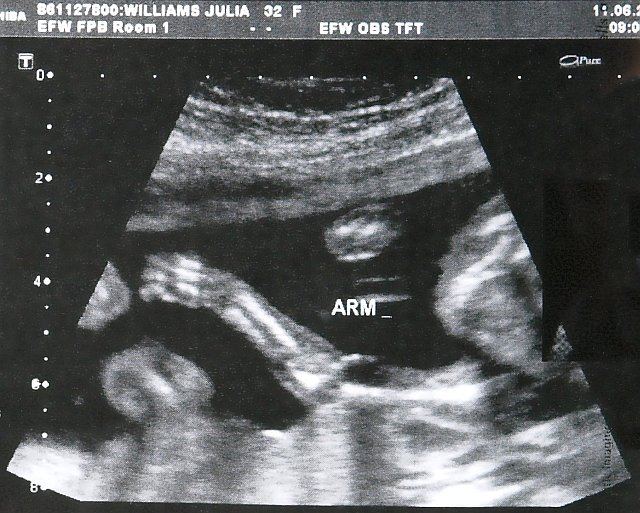 ultrasound 4