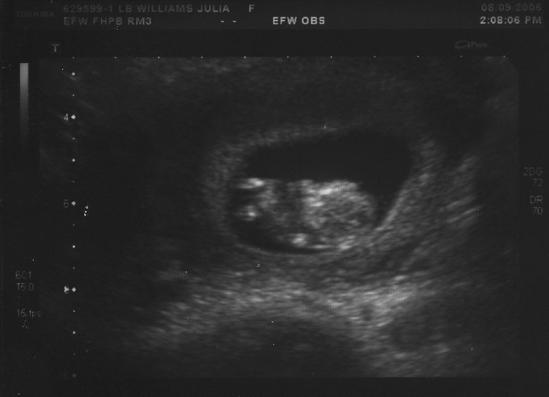 ultrasound 1 2
