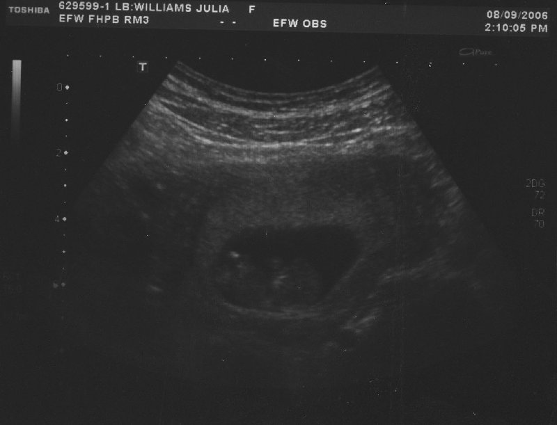ultrasound 1 3