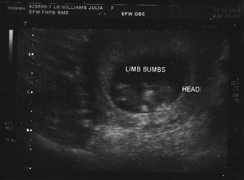 ultrasound 1 4