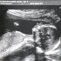 ultrasound_1.jpg
