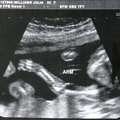 ultrasound_4.jpg