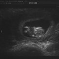 ultrasound_1_2.jpg