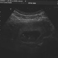 ultrasound_1_3.jpg