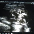 ultrasound_2_1.jpg